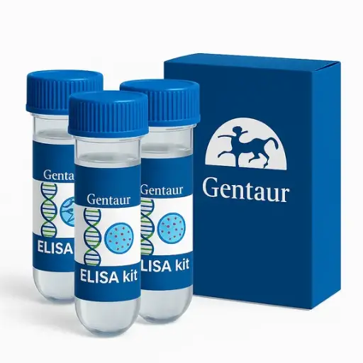[K-YBGL] Yeast Beta Glucan Assay Kit - 100